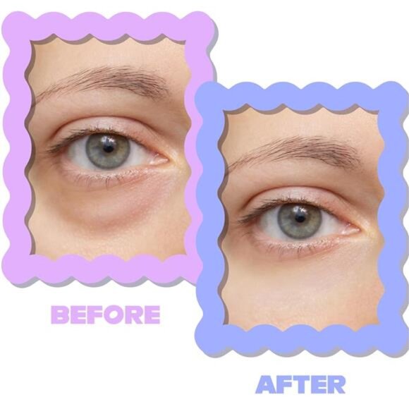 ULTIMATE HYDROGEL EYE MASK DUO-PACK 28 Pairs, Reduce Dark Circles Puffiness Eye - Picture 5 of 7